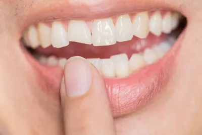 Cosmetic+Dentistry-400w